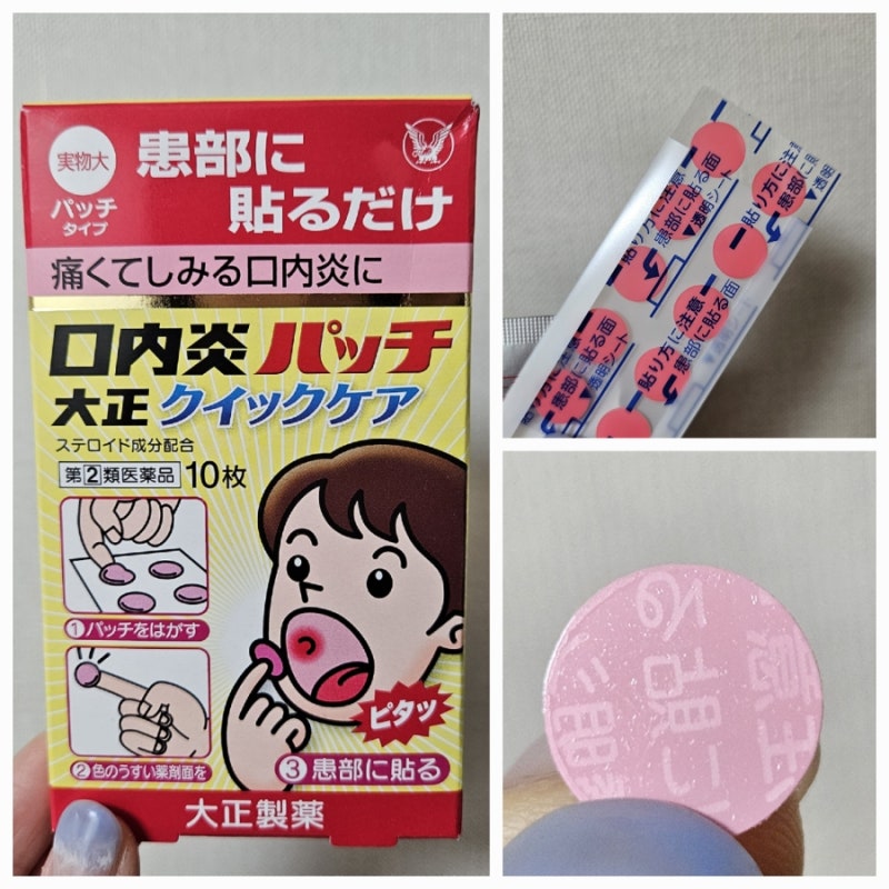 일본 구내염 패치 다이쇼, 입병났을때 필수템