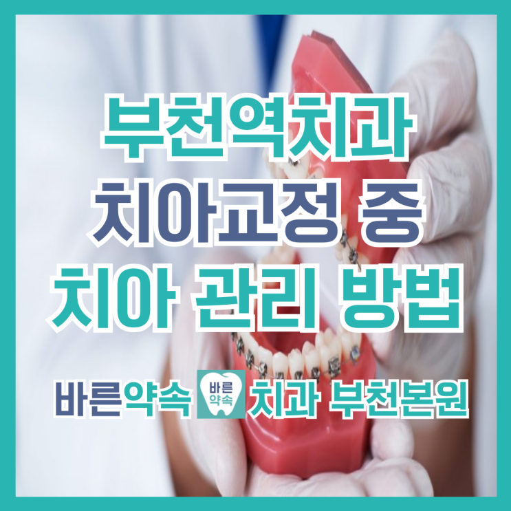  부천역치과 치아교정 중에도 치주관리 놓치면 안 되는 이유