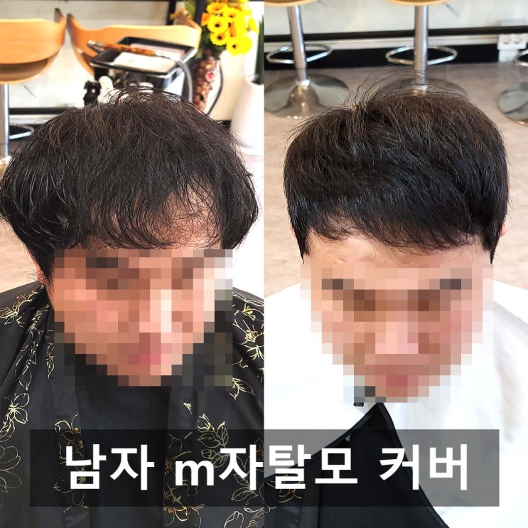  문정동 미용실_남자 m자탈모커버 링거펌 살롱해옴