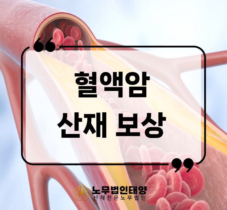  혈액암 초기증상 항암치료 산재 가능 발암물질 입증하기