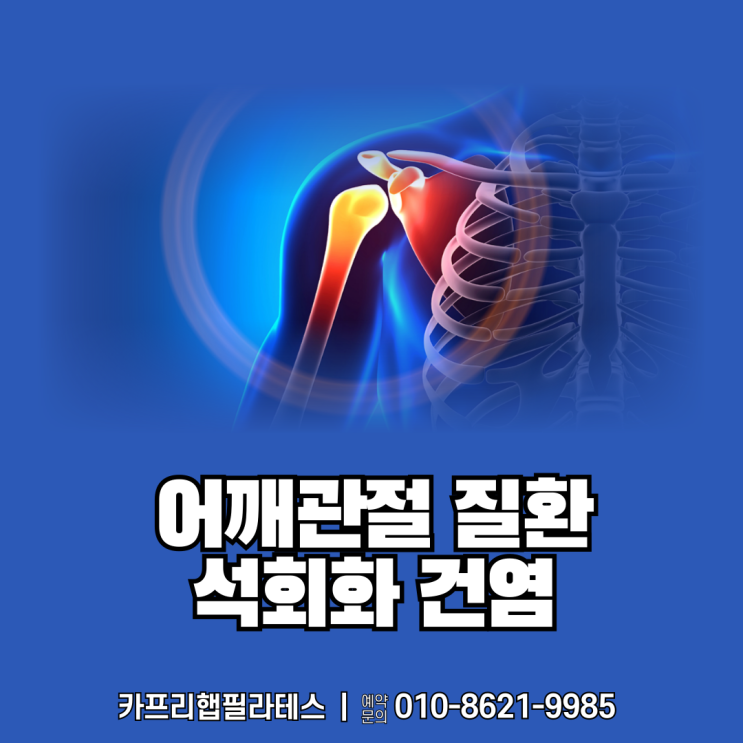  【약수역재활운동】 어깨 통증의 원인 석회화 건염
