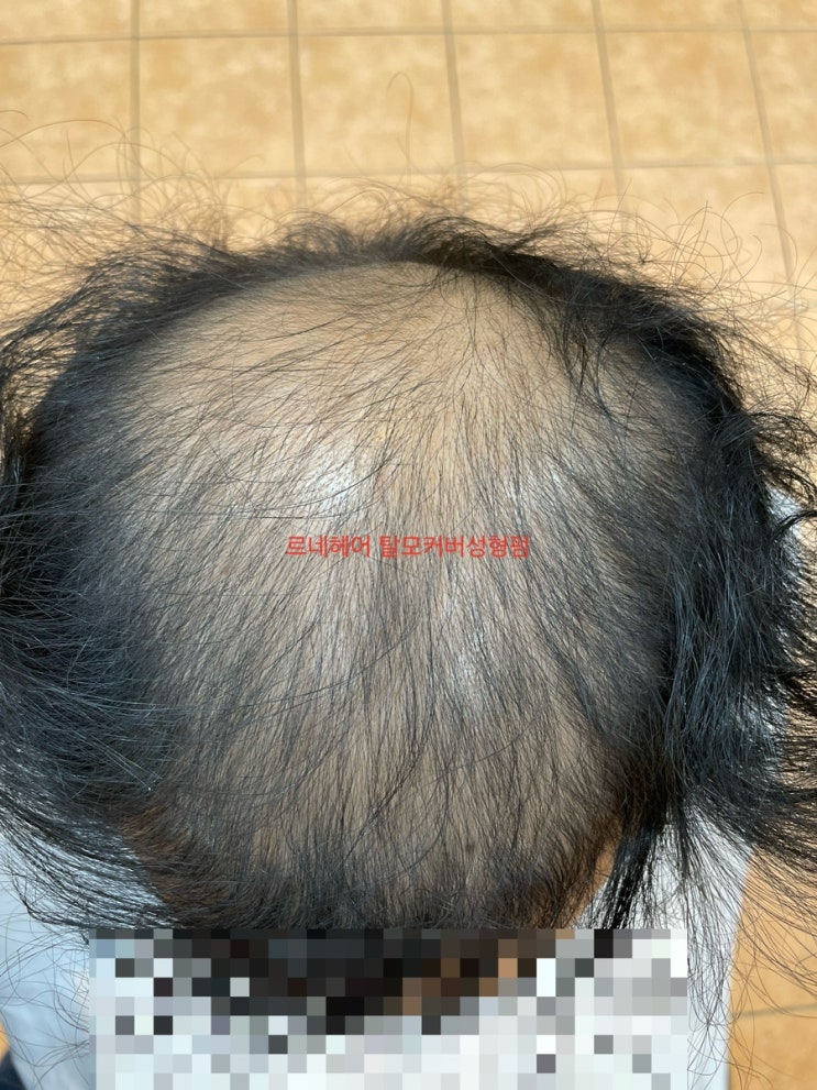  대박 탈모펌 이야기 지금 시작합니다 부산사상구르네시떼6층헤어숍/ 감전주례괘법만덕하단다대김해화명대저녹산장유양산울산거제밀야경주용원진해영도남포초량진구전포연산연제동래해운대광안남천대연수영