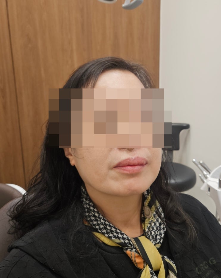  르블랑치과 덴티움 임플란트 받고온 후기