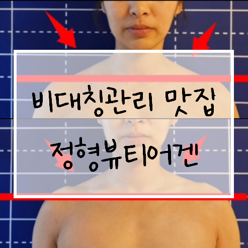  명일동피부관리 정형뷰티어겐에서 신부관리 해보자