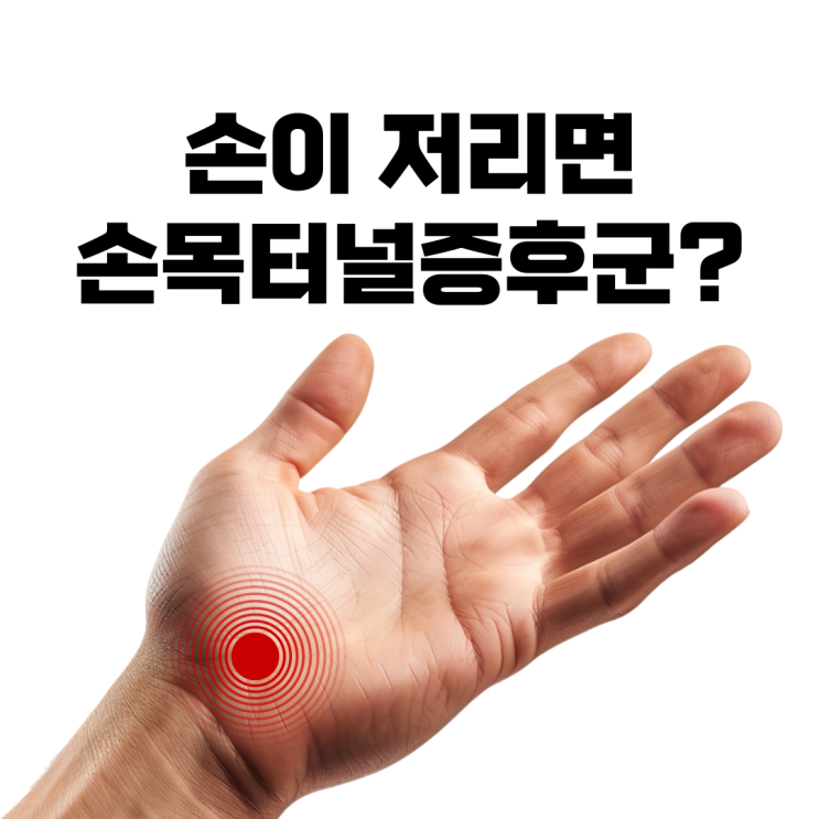 손이 저리면 손목터널 증후군인가? 손이 저리면 손목터널 증후군인가?