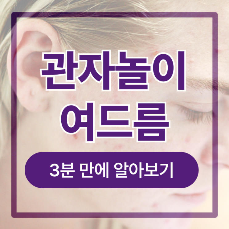  관자놀이 여드름 원인 및 해결책