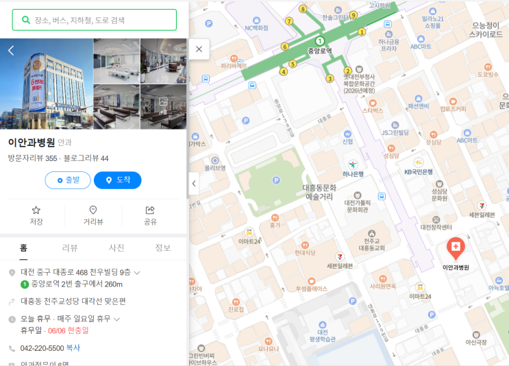  일곱 살(만 5세) 결막염 증상 대전 이안과 진료 후 처방 안약