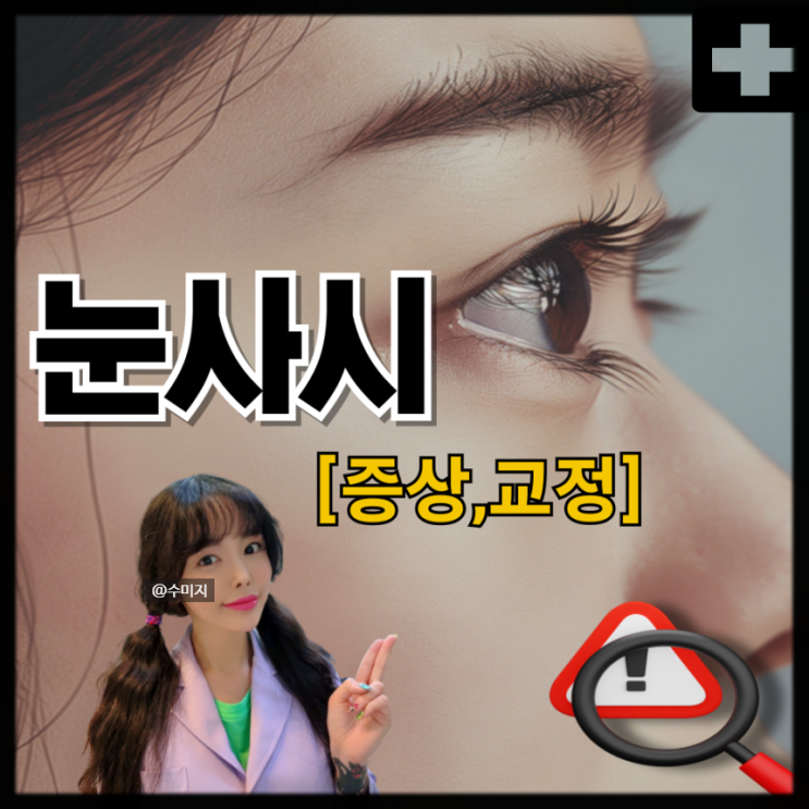  사시 증상 : 간헐적 외사시 내사시 상사시 눈 사시 교정 아기 사시 증상
