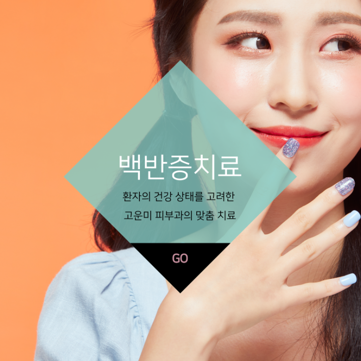  대구동성로백반증치료 효과적인 치료 방법과 관리에 대하여