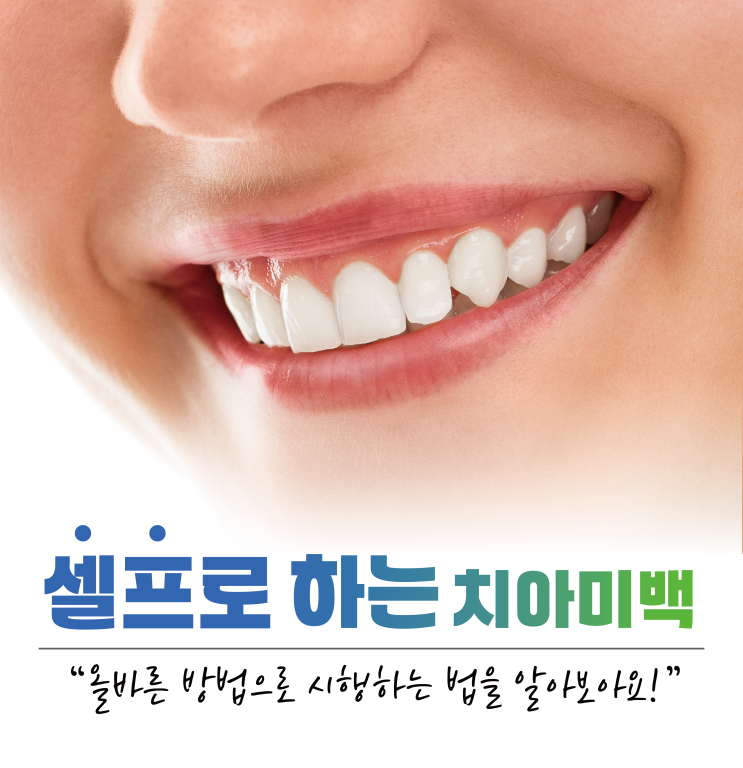  셀프치아미백 하는법 올바른 방법으로 시행해야