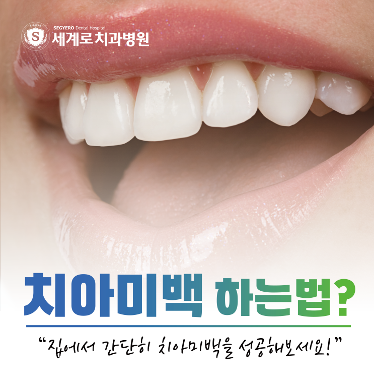  치아미백 집에서 간단히 하길 원한다면