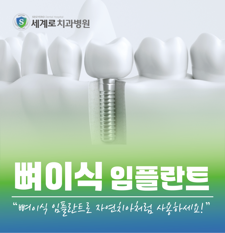  수영동 뼈이식 임플란트 자연치아처럼 사용해요