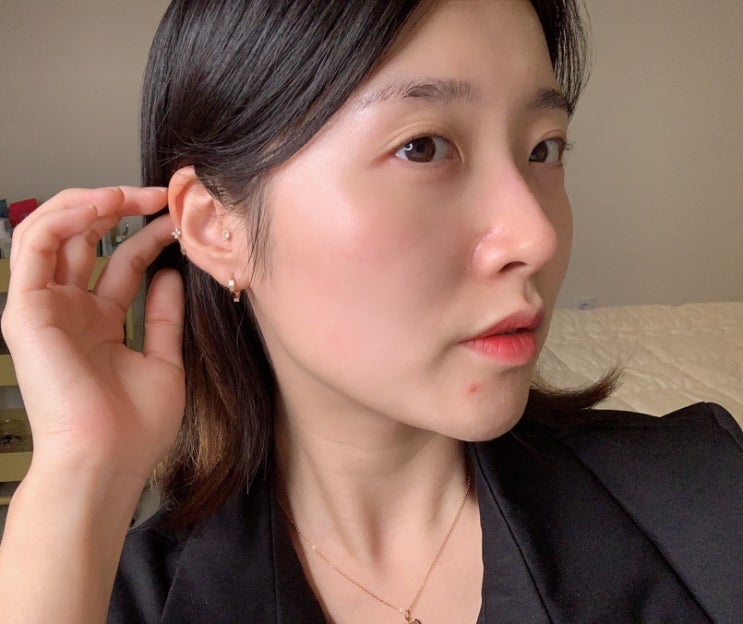  홍조/여드름에 좋다는 그린박신 파이토신 정말 괜찮을까?