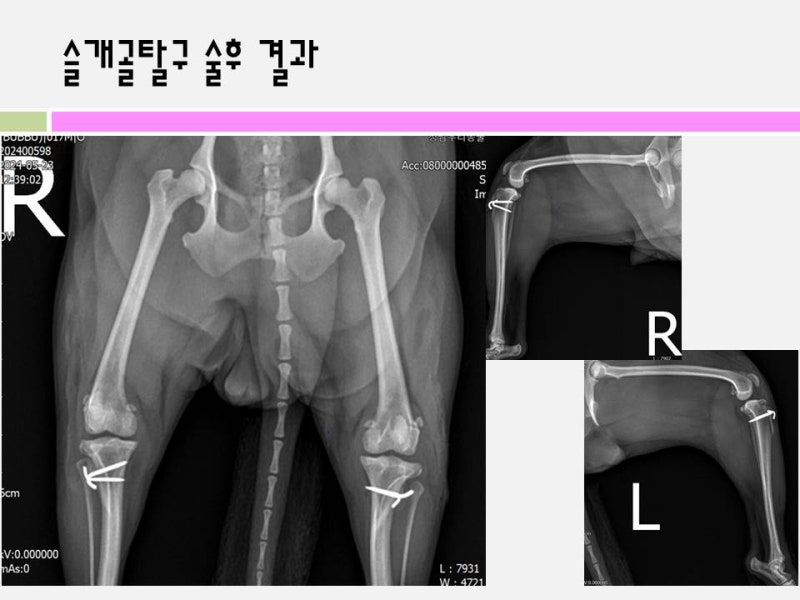 슬개골 탈구 수술 후 X-ray