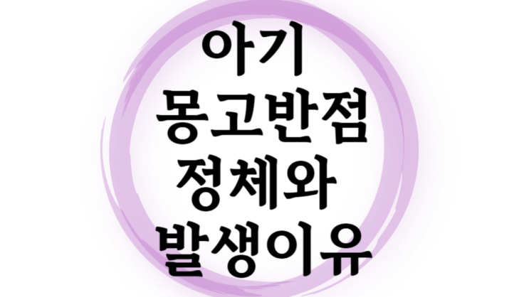  아기 몽고반점의 정체와 발생 이유 : 건강 이상무, 자연스레 없어져요