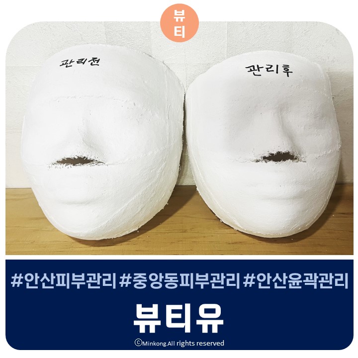 안산 고잔동피부관리 뷰티유 V라인관리 후기