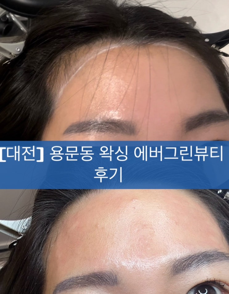  [대전] 용문동 헤어라인 왁싱 잘하는 곳 애버그린뷰티 후기