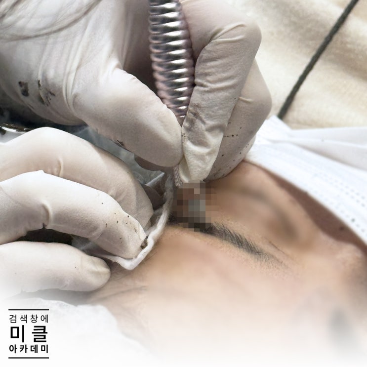  반영구시술 후 연고 메디폼 필요할까