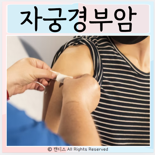  자궁경부암 증상 원인 가다실 예방접종 검사