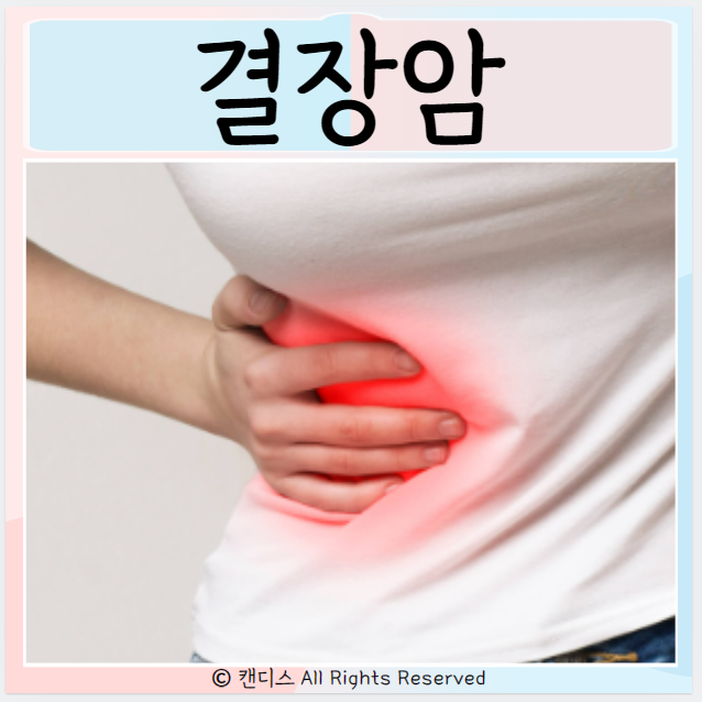  결장암 진단 원인 치료 초기증상