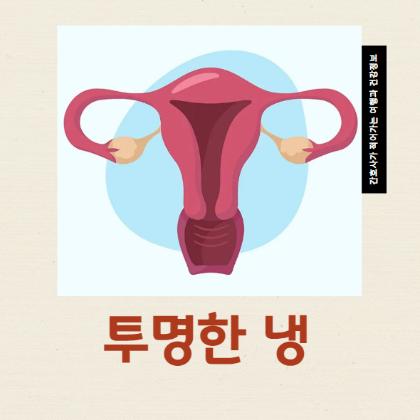  투명냉 생리전 나오는 이유 질염 의심 관리방법
