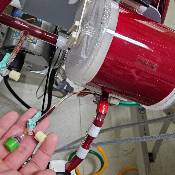  ECMO 간호-2 ECMO 장비,구조 ECMO삽입 방법
