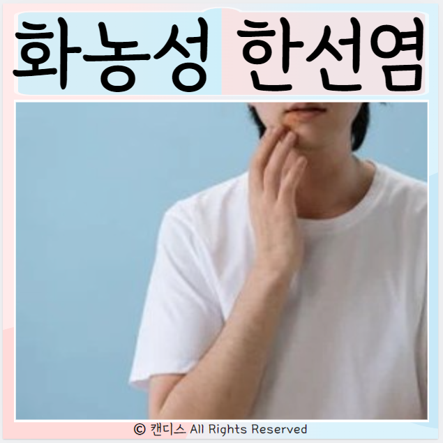  화농성 한선염 원인 치료방법 부위 증상