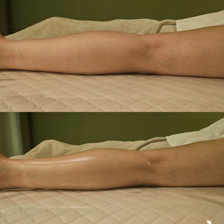  용산 마사지 뉴가닉 테라피 체지방 -1.7kg 미세전류 마사지