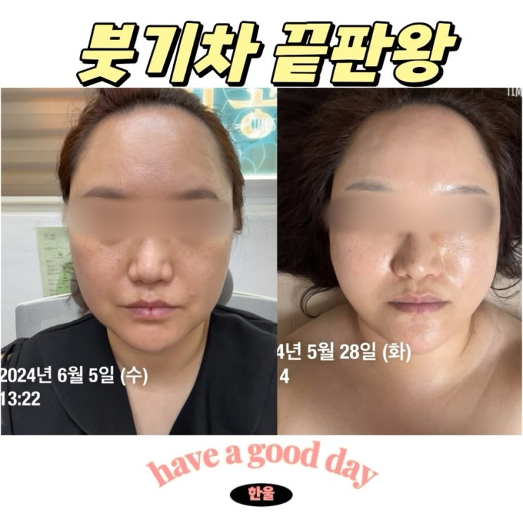  붓기차 추천! 호박차 “스위치온 오붓티” 붓기빠지는 차