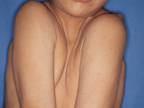  선천성 악안면 기형의 치과교정 및 악정형 보험 치료 (안면기형 교정치료)