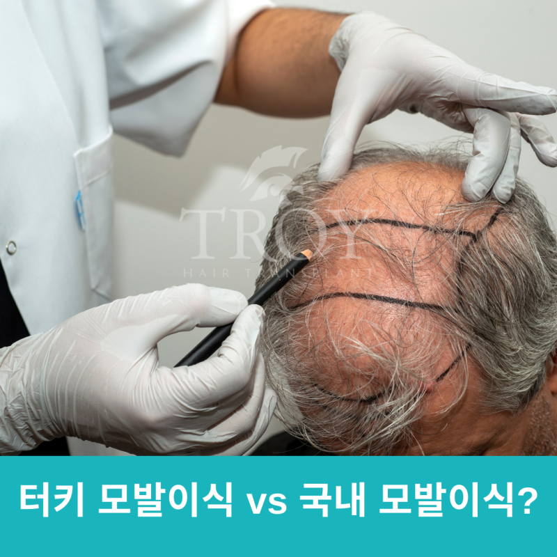 터키 모발이식 vs 국내 모발이식