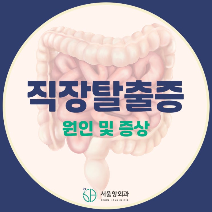  항문 밖으로 튀어나온 직장, 이 질환을 의심해보세요!