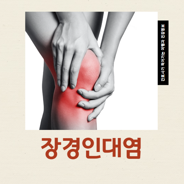  장경인대염 무릎 통증 특징 원인 스트레칭 방법