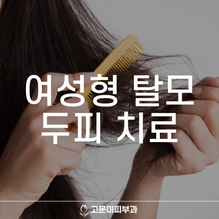  대구반월당탈모치료 여성 탈모 원인과 진행 타입에 따른 맞춤 치료