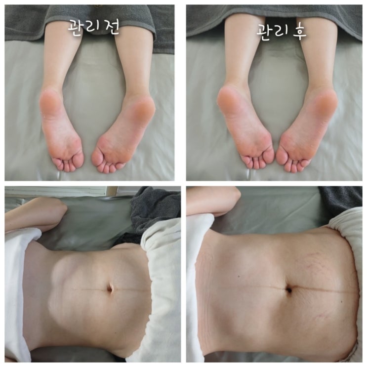  [벨리타마사지] 산후조리 출장 마사지 찐 후기 완전 만족한 마사지 추천