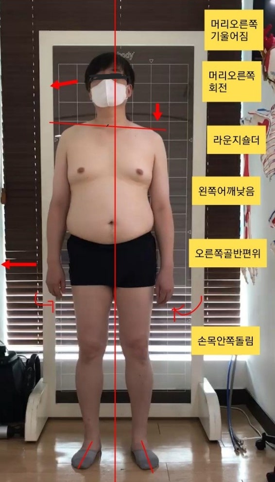  [부산 동래 사직동 무릎통증] 자세교정으로 무릎통증을 개선한 회원님 비포에프터 사례소개