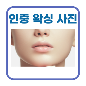  화장하기 전 인중 왁싱 필수, 시술 사진 feat. 마산 마이뷰티