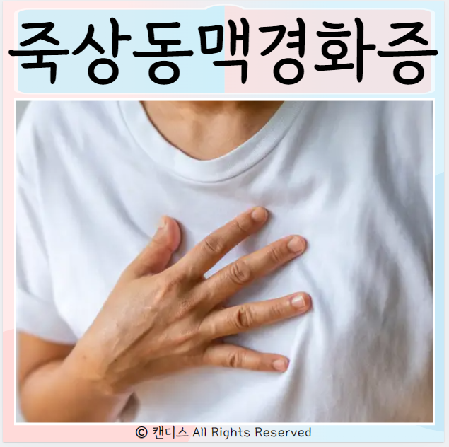  죽상경화증 동맥경화증 위험 원인 치료 증상