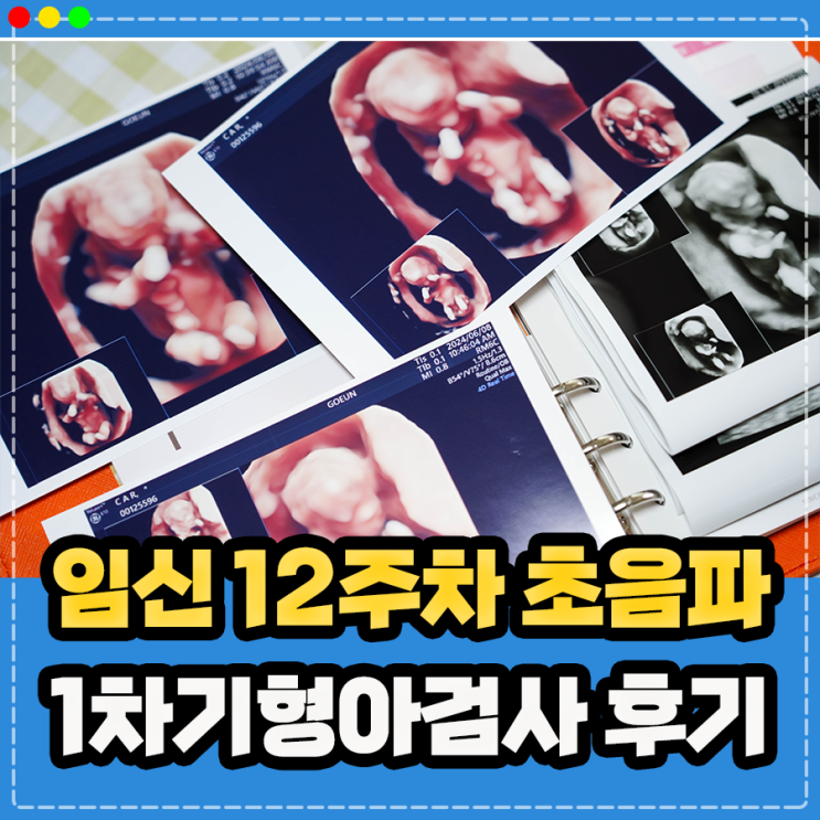  임신 12주 초음파, 1차 기형아검사(다운증후군, 목투명대 NT검사 및 입체 3D 정밀초음파) 후기