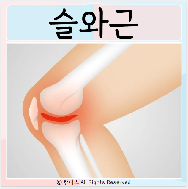  슬와근 위치 손상원인 증상 관리 통증