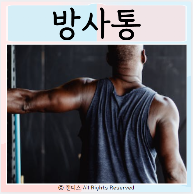  방사통 원인 척추협착증 좌골 신경통 치료 증상 관리