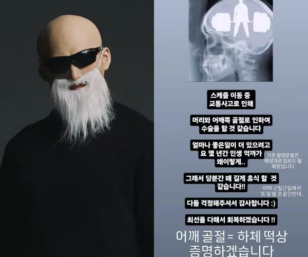 인기 운동 유튜버 <b>김계란</b>, <b>교통사고로</b> 인한 장기 휴식 예고