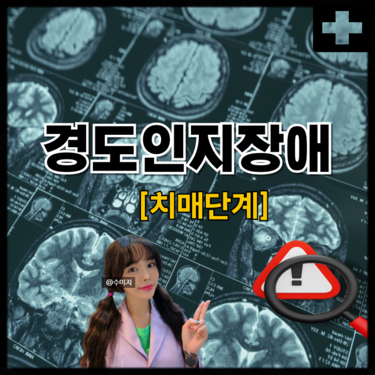  치매예방법 건망증 치매 증상 경도인지장애