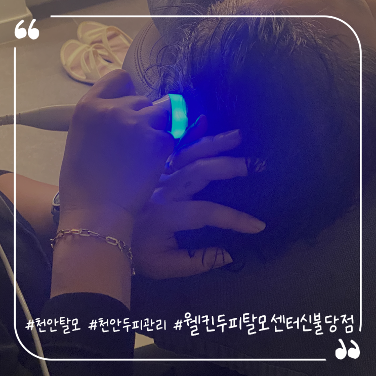  천안탈모성지 천안두피관리 웰킨두피탈모센터신불당점 여성탈모케어후기
