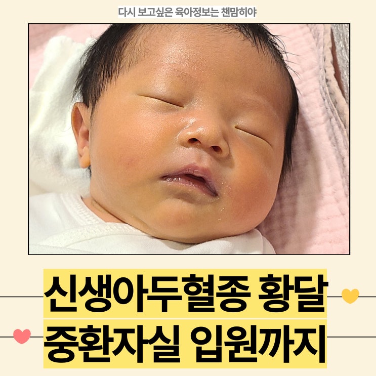  신생아 아기두혈종 관리방법 중환자실 입원 황달 광선치료까지