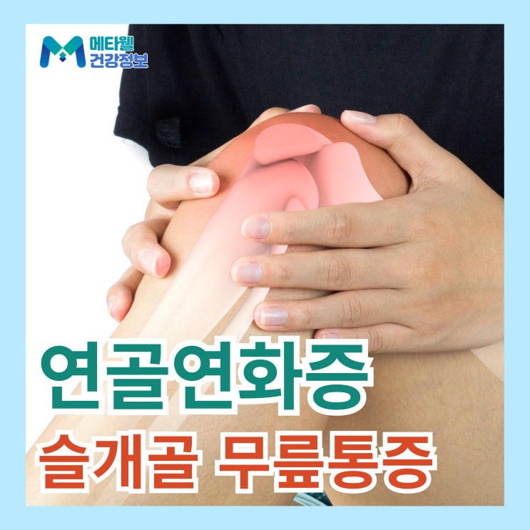  가만히 서있는데 무릎이 아파요 20대 슬개골연골연화증 증상, 치료, 연골연화증 통증 무릎 뚝소리