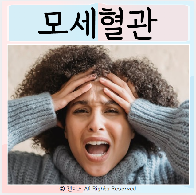  모세혈관 확장증 치료 증상 원인