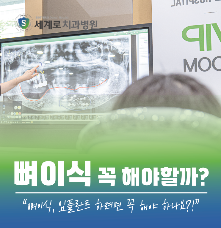  뼈이식, 임플란트 하려면 꼭 해야 하나요?