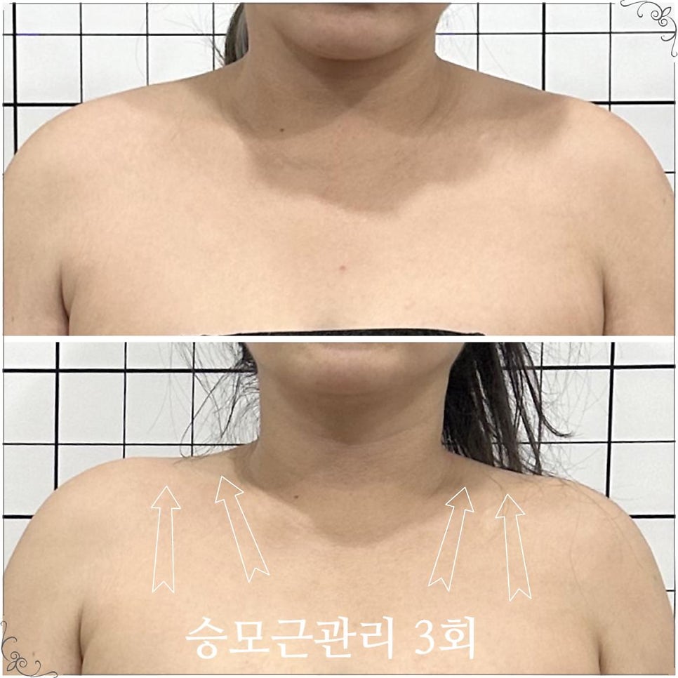 더예쁨 사진 3