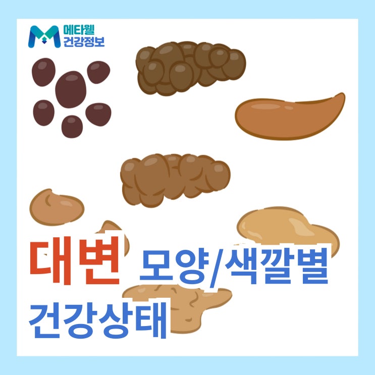  내 똥 모양 정상일까? 대변 모양과 색깔로 알아보는 내 몸의 건강 상태